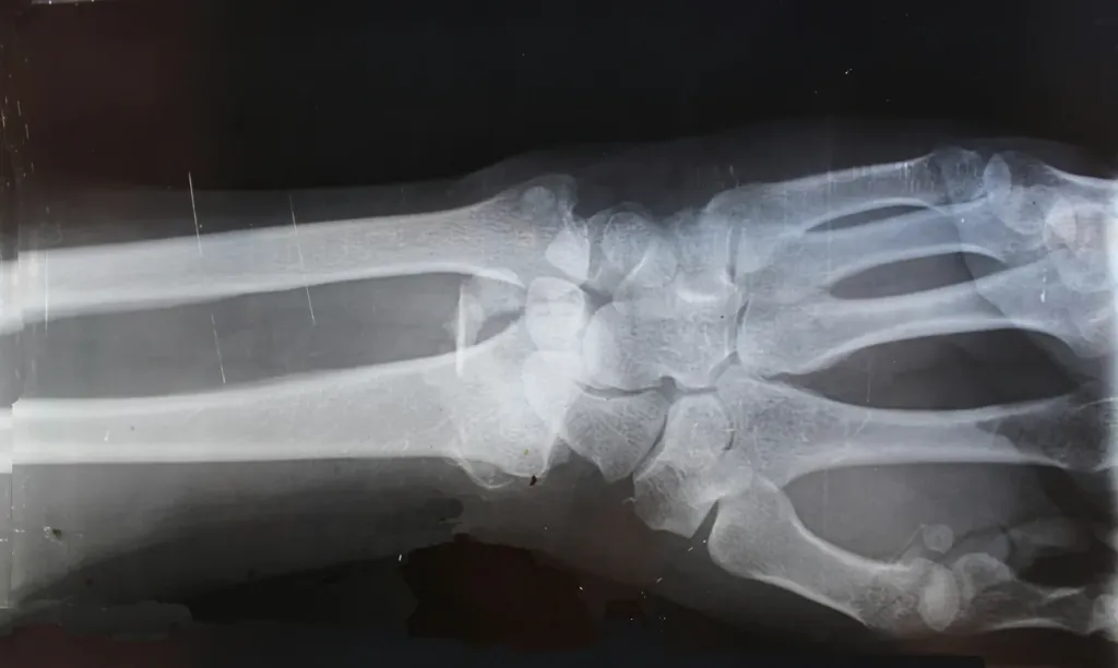 Kiedy warto wynająć mobilną maszynę do rezonansu magnetycznego (foto)